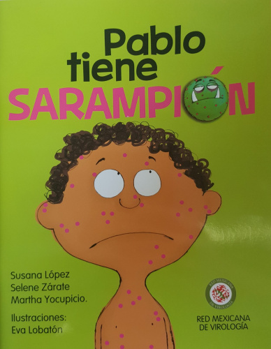 Pablo tiene sarampión